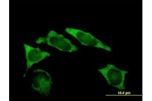 Immunofluorescence of purified MaxPab antibody to IMP-2 on HeLa cell. (IGF2BP2 antibody  (AA 1-598))