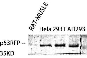 Western Blot (WB) analysis of specific cells using p53RFP Polyclonal Antibody.