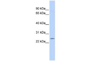 WB Suggested Anti-PSMB5 Antibody Titration: 0. (PSMB5 antibody  (Middle Region))