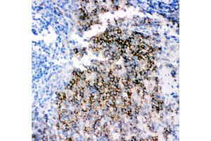 Anti- CD79B picoband antibody,IHC(P) IHC(P): Rat Spleen Tissue (CD79b antibody  (AA 29-229))