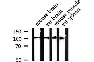 Western blot analysis of Actin α-2/3 expression in various lysates (ACTN3 antibody  (N-Term))