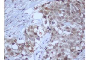 Image no. 14 for anti-DEAD (Asp-Glu-Ala-Asp) Box Polypeptide 59 (DDX59) (AA 1-303) antibody (ABIN1490728)