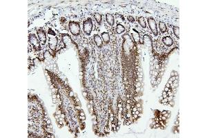 IHC analysis of PTBP1 using anti-PTBP1 antibody (ABIN7599451). (PTBP1 antibody  (AA 1-504))
