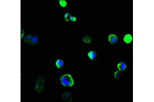 Immunofluorescence staining of MCF-7 cells with ABIN7161502 at 1:166, counter-stained with DAPI. (NCF4 antibody  (AA 136-239))