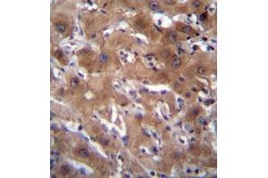 Formalin fixed, paraffin embedded human liver tissue stained with RASSF10 Antibody  followed by peroxidase conjugation of the secondary antibody and DAB staining. (RASSF10 antibody  (Middle Region))