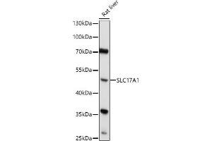 Western blot analysis of extracts of Rat liver, using SLC17 antibody (6642) at 1:1000 dilution. (SLC17A1 antibody  (AA 1-100))