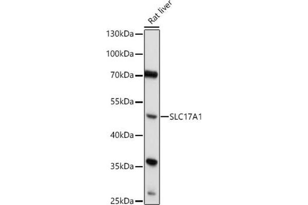 SLC17A1 antibody  (AA 1-100)