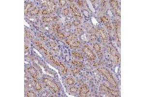Immunohistochemical staining of human kidney with ANKS4B polyclonal antibody  shows strong membranous positivity in cells in tubules. (ANKS4B antibody)
