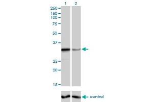 Western blot analysis of ZNF346 over-expressed 293 cell line, cotransfected with ZNF346 Validated Chimera RNAi (Lane 2) or non-transfected control (Lane 1). (ZNF346 antibody  (AA 133-232))