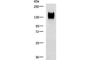 Western blot analysis of A549 cell lysate using CEACAM1 Polyclonal Antibody at dilution of 1:500 (CEACAM1 antibody)