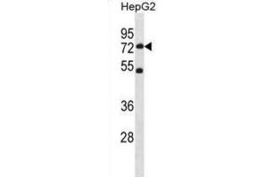 Western Blotting (WB) image for anti-SET Domain Containing 3 (SETD3) antibody (ABIN3001114) (SETD3 antibody)