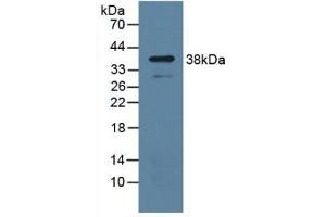 Detection of UPP1 in Mouse Lung Tissue using Polyclonal Antibody to Uridine Phosphorylase 1 (UPP1) (UPP1 antibody  (AA 1-277))