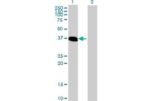ZNF444 Antikörper  (AA 1-326)