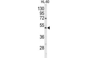 Western Blotting (WB) image for anti-Polymerase (DNA Directed), gamma 2, Accessory Subunit (POLG2) antibody (ABIN3001661) (POLG2 antibody)