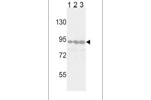 Western blot analysis of TYRO10 Antibody (ABIN392069 and ABIN2841832) in Jurkat(lane 1), 293(lane 2) and Hela(lane 3) cell line lysates (35 μg/lane). (DDR2 antibody)