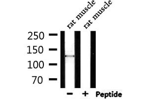 Western blot analysis of extracts from rat muscle, using SPZ1 Antibody. (SPZ1 antibody  (Internal Region))