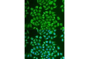 Immunofluorescence analysis of U2OS cells using PIP antibody (ABIN5973796). (PIP antibody)