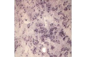 IHC on rat brain using Rabbit antibody to extracellular, N-terminal part of Sortilin (Neurotensin receptor 3, NTR3, Sort1): IgG  at a concentration of 10 µg/ml. (Sortilin 1 antibody)