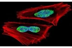 Fluorescent confocal image of A2058 cell stained with RBPJ antibody. (RBPJ antibody  (AA 1-29))