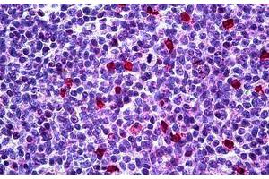 Immunohistochemistry (Formalin-fixed Paraffin-embedded Sections) (IHC (fp)) image for anti-Cyclin-Dependent Kinase Inhibitor 1B (p27, Kip1) (CDKN1B) (AA 1-199) antibody (ABIN626030)