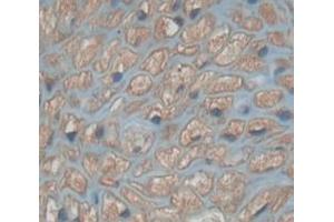 Figure. (PAX9 antibody  (AA 1-341))