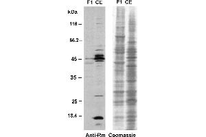 Western blot analysis of proteins from the eyespot fraction F1 and a CE with the anti-methyl-arginine specific antibody 7E6. (Methylated Arginine (MMA+ADMA+SDMA) antibody)