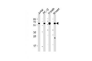 All lanes : Anti-CK2 beta Antibody (C-term) at 1:2000 dilution Lane 1: Jurkat whole cell lysate Lane 2: PC-12 whole cell lysate Lane 3: human brain lysate Lane 4: mouse heart lysate Lysates/proteins at 20 μg per lane. (CAMK2B antibody  (AA 1-503))