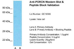 Host: Rabbit  Target Name: PORCN  Sample Tissue: Hela Whole cell  Lane A:  Primary Antibody Lane B:  Primary Antibody + Blocking Peptide Primary Antibody Concentration: 1 µg/mL Peptide Concentration: 5 µg/mL Lysate Quantity: 41 µg/laneGel Concentration:. (PORCN antibody  (N-Term))