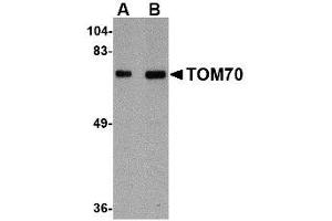 Image no. 1 for anti-Translocase of Outer Mitochondrial Membrane 70 (TOMM70A) (Internal Region) antibody (ABIN341714) (TOM70 antibody  (Internal Region))