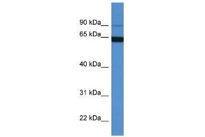 WB Suggested Anti-MAP6 Antibody Titration: 0. (MAP6 antibody  (N-Term))