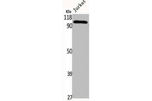 TAO Kinase 3 antibody  (Internal Region)