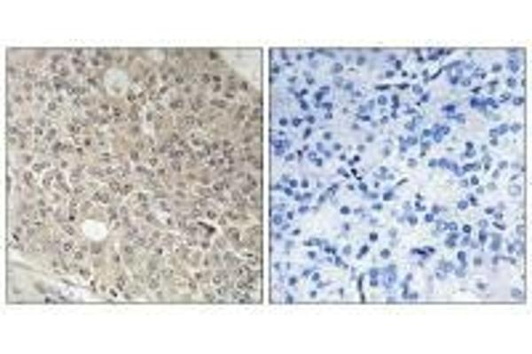 AMOTL1 antibody