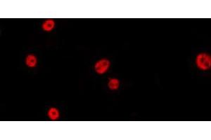 ABIN6275391 staining HepG2 by IF/ICC. (CDC40 antibody)
