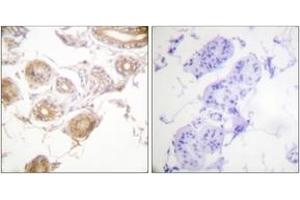 Immunohistochemistry analysis of paraffin-embedded human skin, using ETK (Phospho-Tyr40) Antibody. (BMX antibody  (pTyr40))