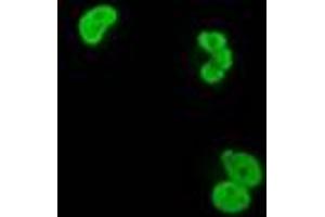 Anti-XRCC1 mouse monoclonal antibody (ABIN2453797) immunofluorescent staining of COS7 cells transiently transfected by pCMV6-ENTRY XRCC1 (RC204952).