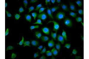 Immunofluorescence staining of A549 cells with ABIN7172685 at 1:166, counter-stained with DAPI. (TAF4B antibody  (AA 132-244))