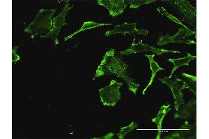 Immunofluorescence of monoclonal antibody to REN on HeLa cell. (Renin antibody  (AA 24-406))