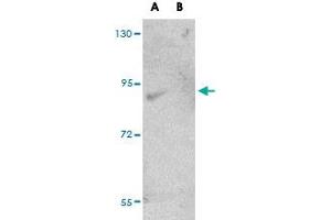 Western blot analysis of FAM59A in rat liver tissue lysate with FAM59A polyclonal antibody  at (A) 1 and (B) 2 ug/mL .