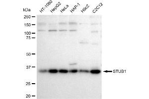 Western blotting analysis using STUB1 antibody (ABIN7800441). (Recombinant STUB1 antibody)
