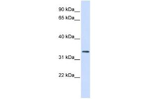 FBXO25 antibody used at 1 ug/ml to detect target protein. (FBXO25 antibody  (N-Term))