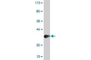 Western Blot detection against Immunogen (37. (PAX8 antibody  (AA 141-250))