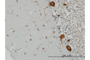 Immunoperoxidase of monoclonal antibody to FARSLB on formalin-fixed paraffin-embedded human cerebellum. (FARSB antibody  (AA 234-341))