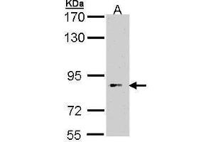 WB Image Sample (30 ug of whole cell lysate) A: Hep G2 , 7. (BBS12 antibody)