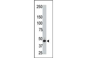 The anti-HtrA3 N-term Pab (ABIN1882095 and ABIN2846350) is used in Western blot to detect HtrA3 in rat testis tissue lysate. (HTRA3 antibody  (N-Term))