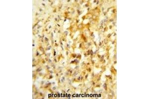Immunohistochemistry (IHC) image for anti-NK3 Homeobox 1 (NKX3-1) antibody (ABIN3003998) (NKX3-1 antibody)