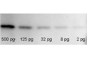 Western Blotting (WB) image for RFP Western Blot Kit: for RFP Chemiluminescent Western Blotting (ABIN2669872)