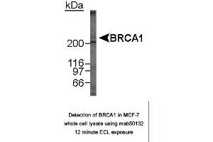 Image no. 2 for anti-Breast Cancer 1 (BRCA1) (AA 1314-1600), (AA 1314-1864) antibody (ABIN363286) (BRCA1 antibody  (AA 1314-1600, AA 1314-1864))
