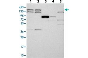 Western blot analysis of Lane 1: RT-4, Lane 2: U-251 MG, Lane 3: Human Plasma, Lane 4: Liver, Lane 5: Tonsil with DHX38 polyclonal antibody  at 1:250-1:500 dilution.