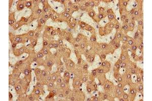 Immunohistochemistry of paraffin-embedded human liver tissue using ABIN7158476 at dilution of 1:100 (CES1 antibody  (AA 291-566))