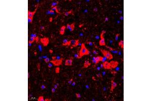 Immunofluorescence of paraffin embedded mouse epencephalon using UTS2 (ABIN7076162) at dilution of 1:2000 (400x lens) (Urotensin 2 antibody)